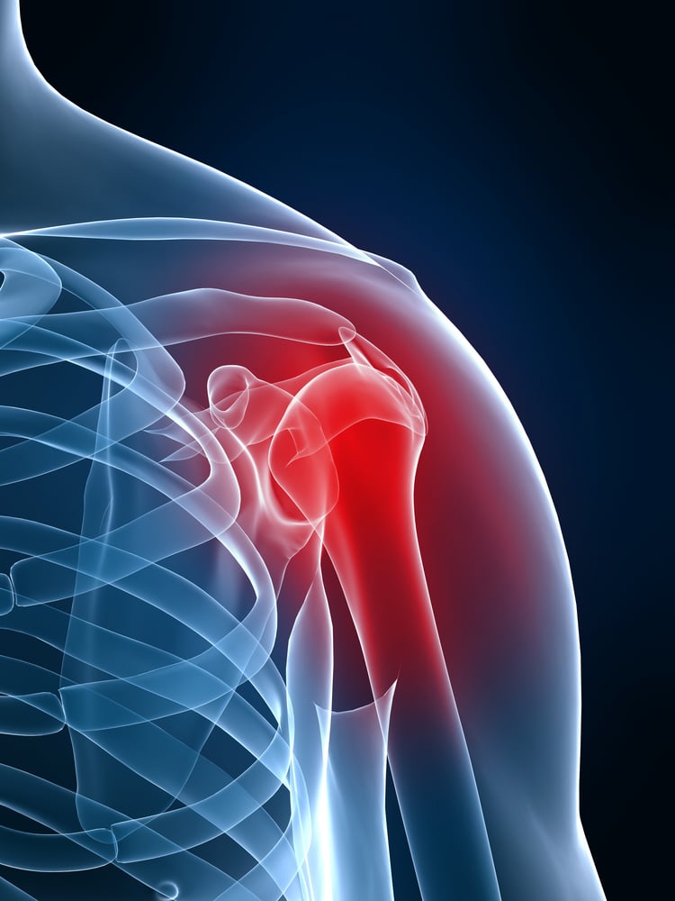 Shoulder And Neck Injury Lawyer In Nevada Nevada Workers' Compensation For Shoulder And Neck Injuries